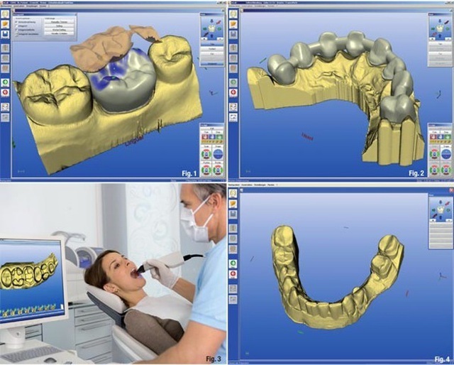  In sinh học: Ứng dụng in 3D trong y khoa - 10