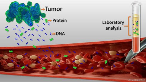 DT 362 Cancer SEEK Hình 2 (1).jpg