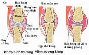 DT 319 TẾ BÀO GỐC THOÁI KHỚP 2