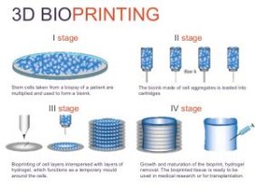 DT 338 3D PRINTING IN MEDICINE 2