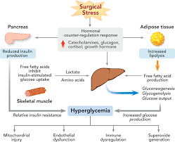 STRESS HYPERGLYCEMIA 1