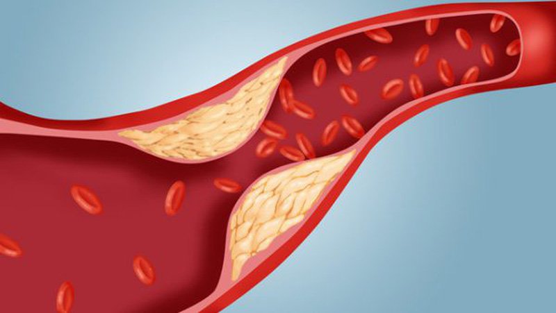 cholesterol